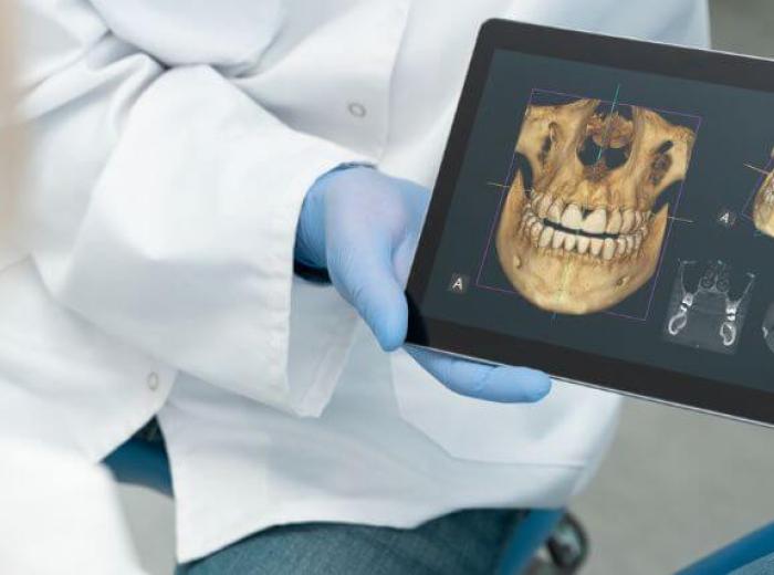Dental Cone Beam CT Scans: When 3D Imaging is Necessary