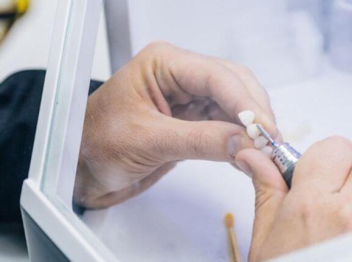 Common Issues Addressed by Restorative Dentistry: From Cavities to Missing Teeth